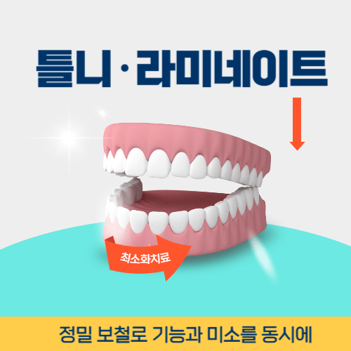 경주치과 경주시 치과 틀니 라미네이트